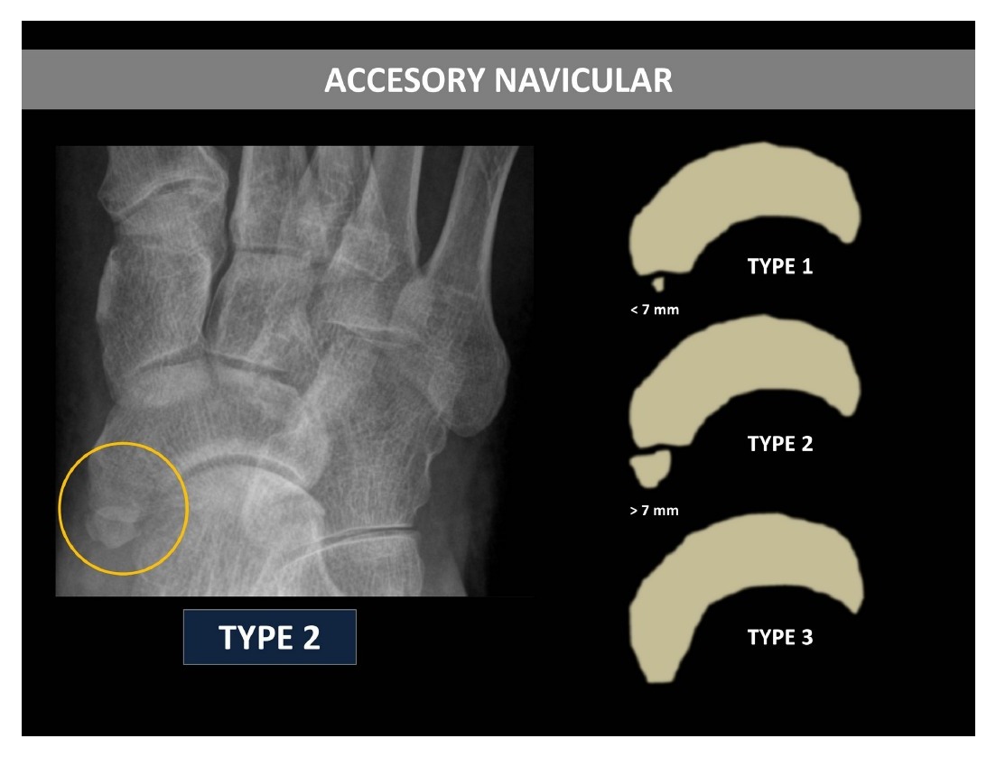 Radiograph / imaging