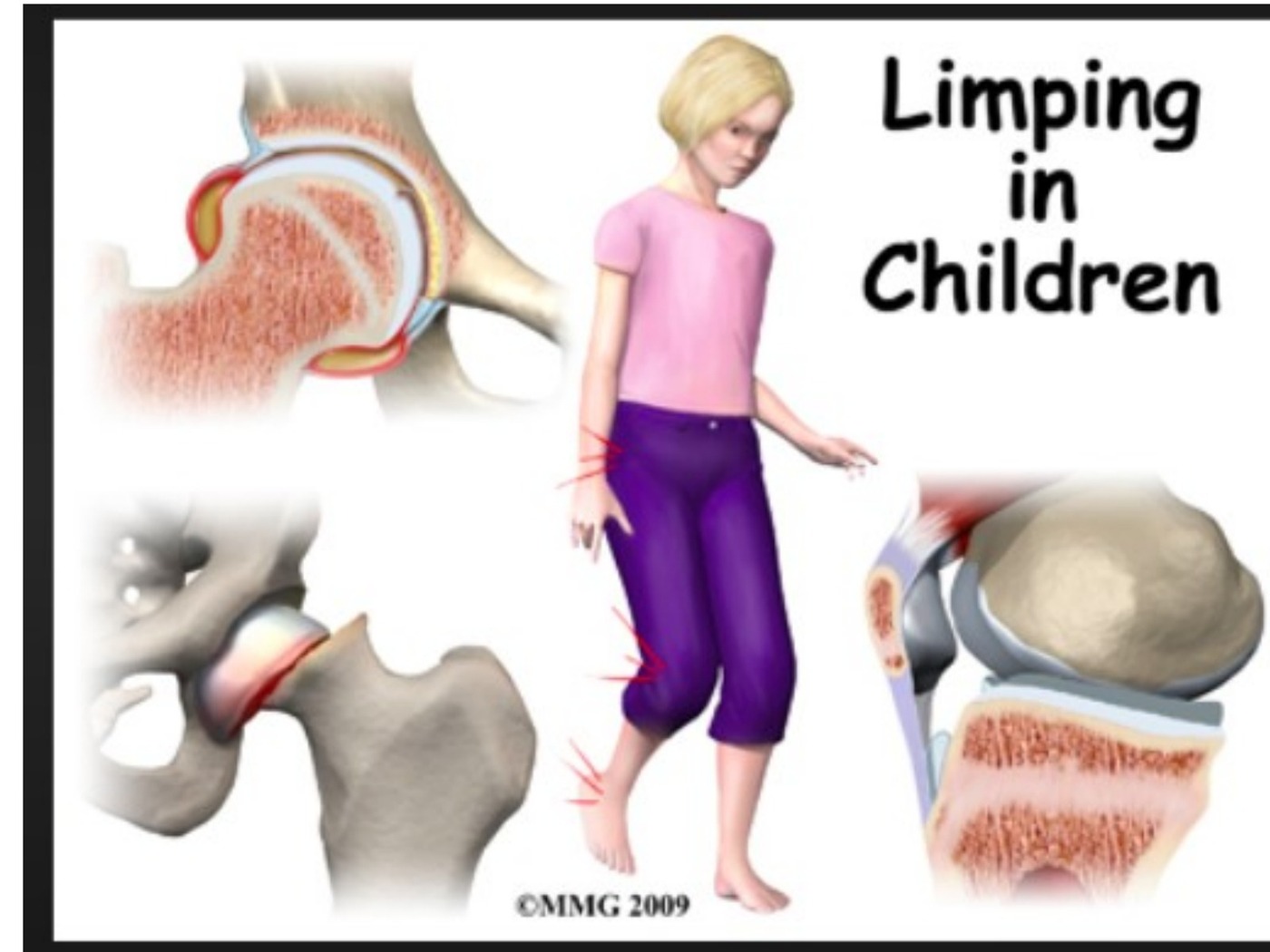 Clinical photograph