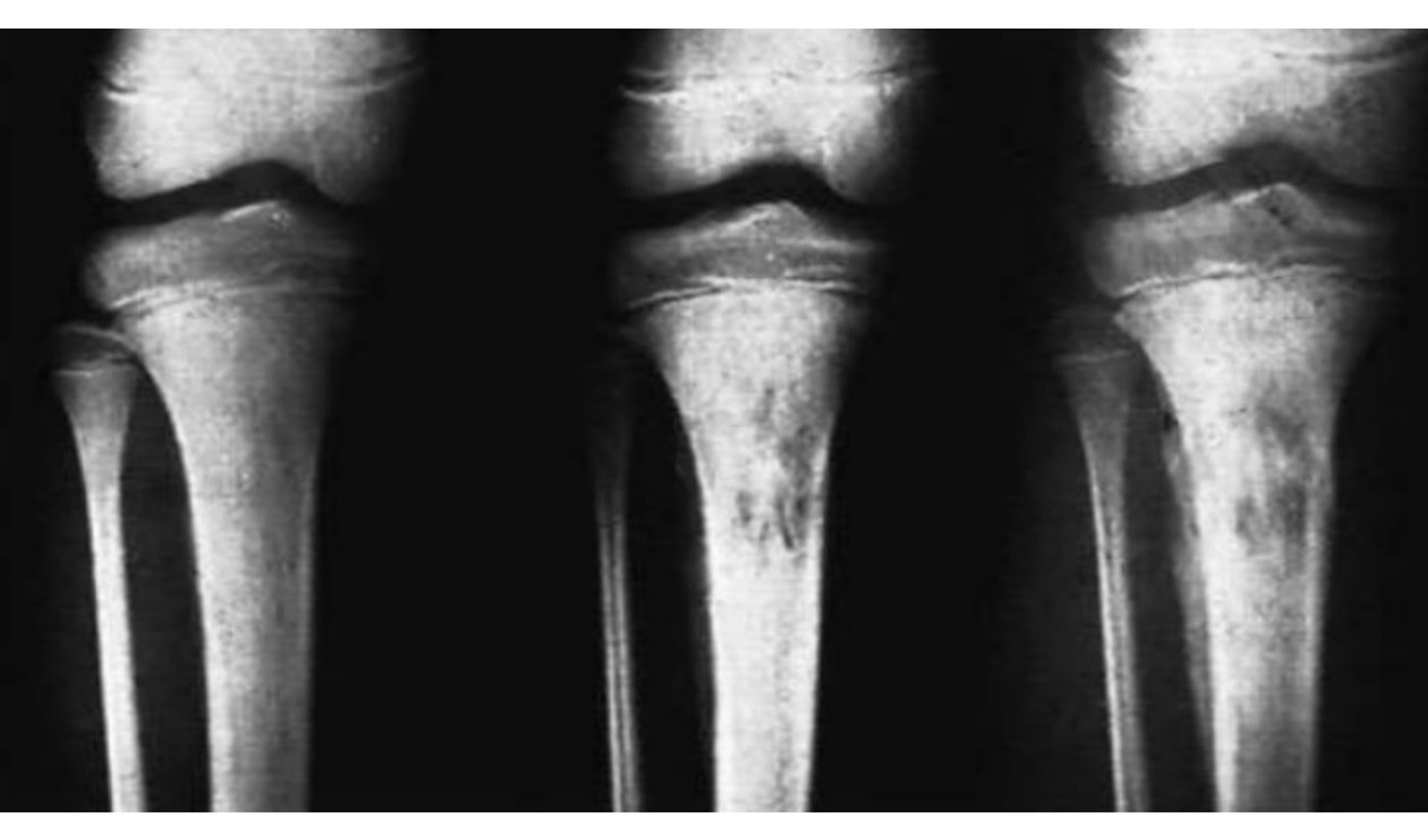 Radiograph / imaging