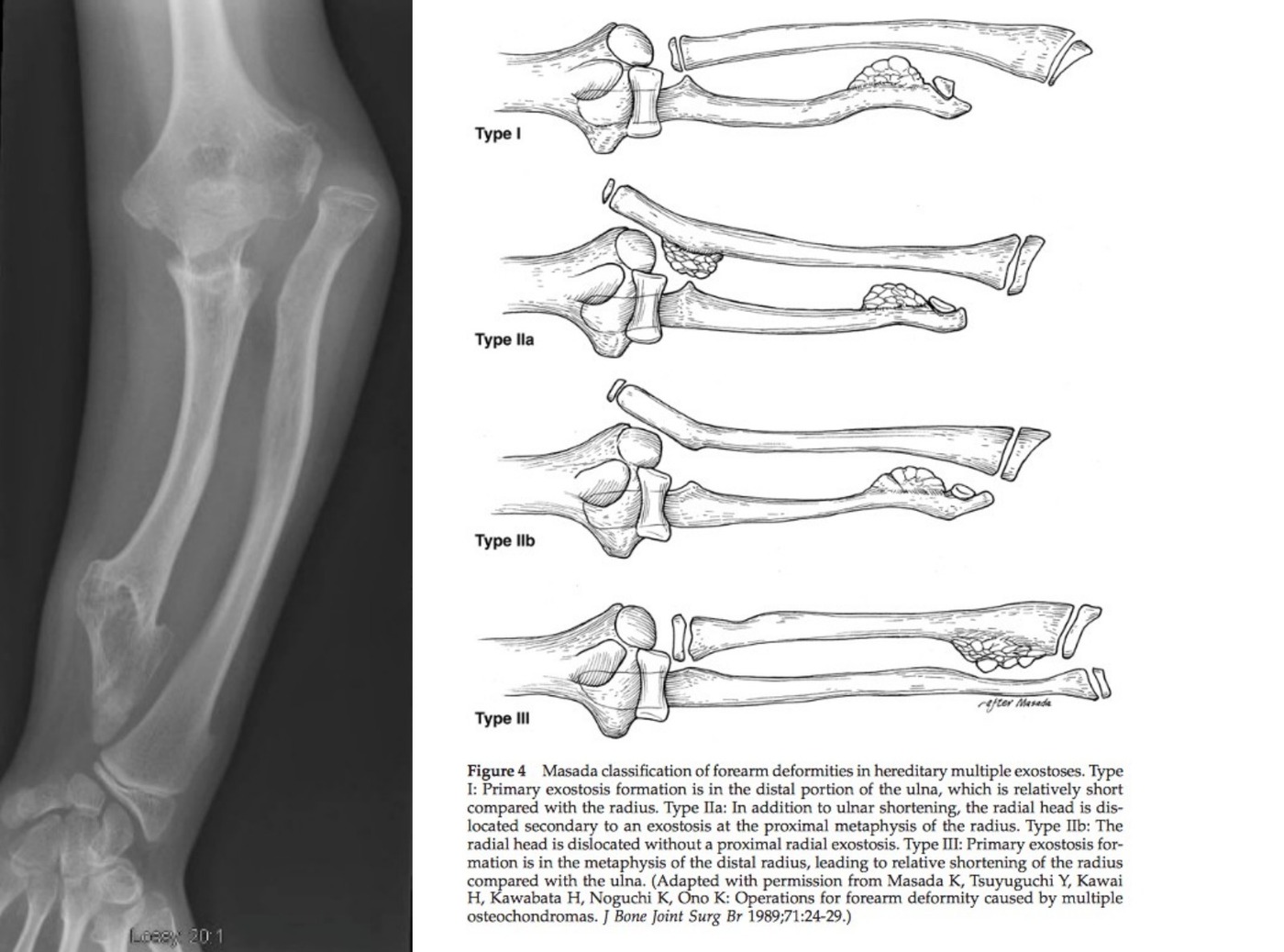 Radiograph / imaging