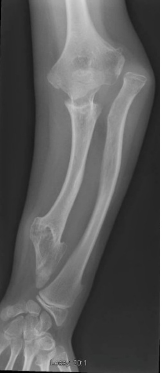 Radiograph / imaging