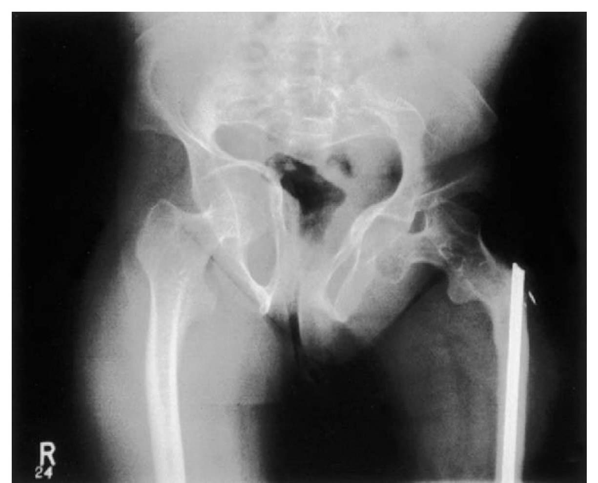 Ultrasound image