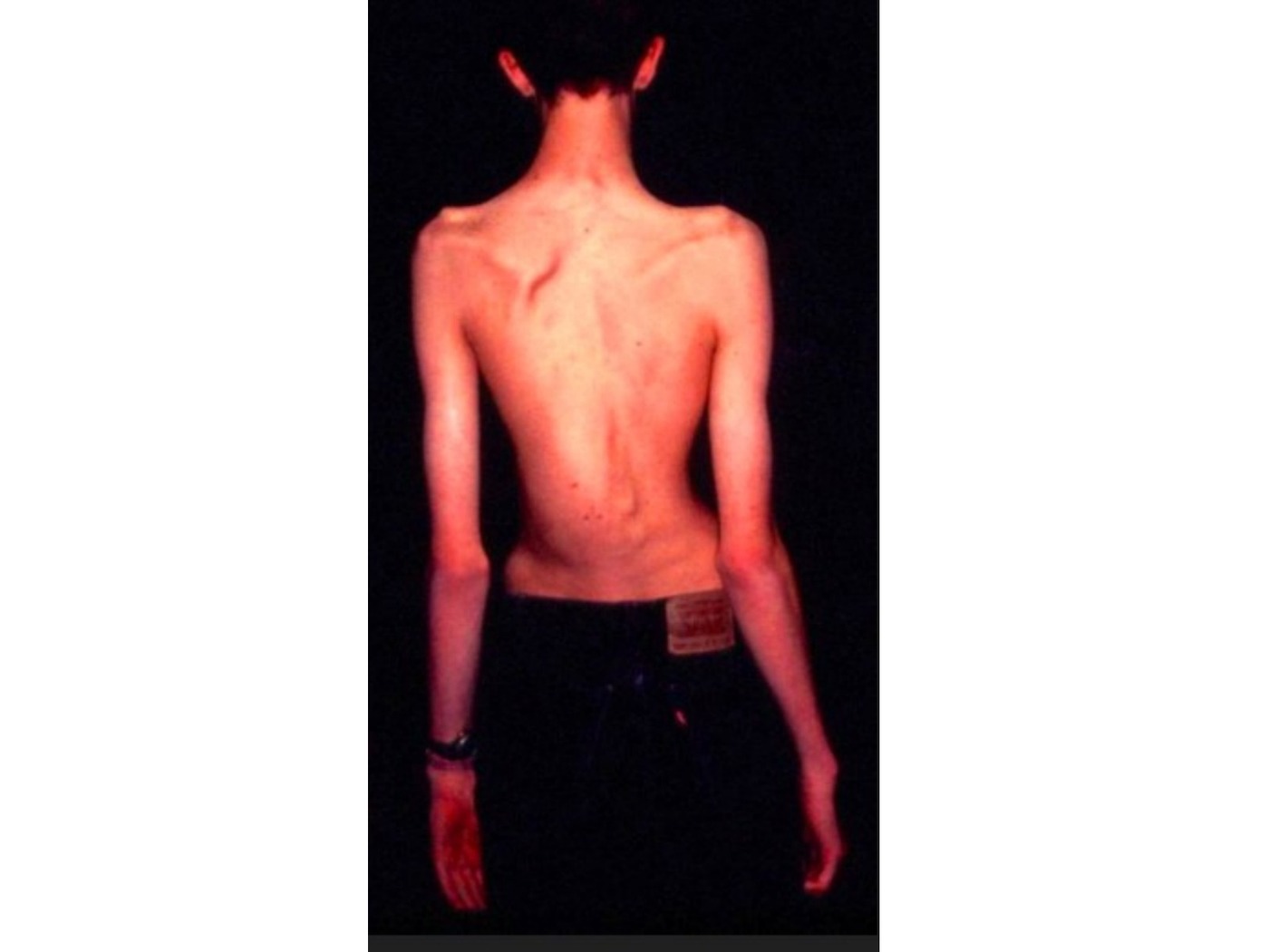 Operative / approach image