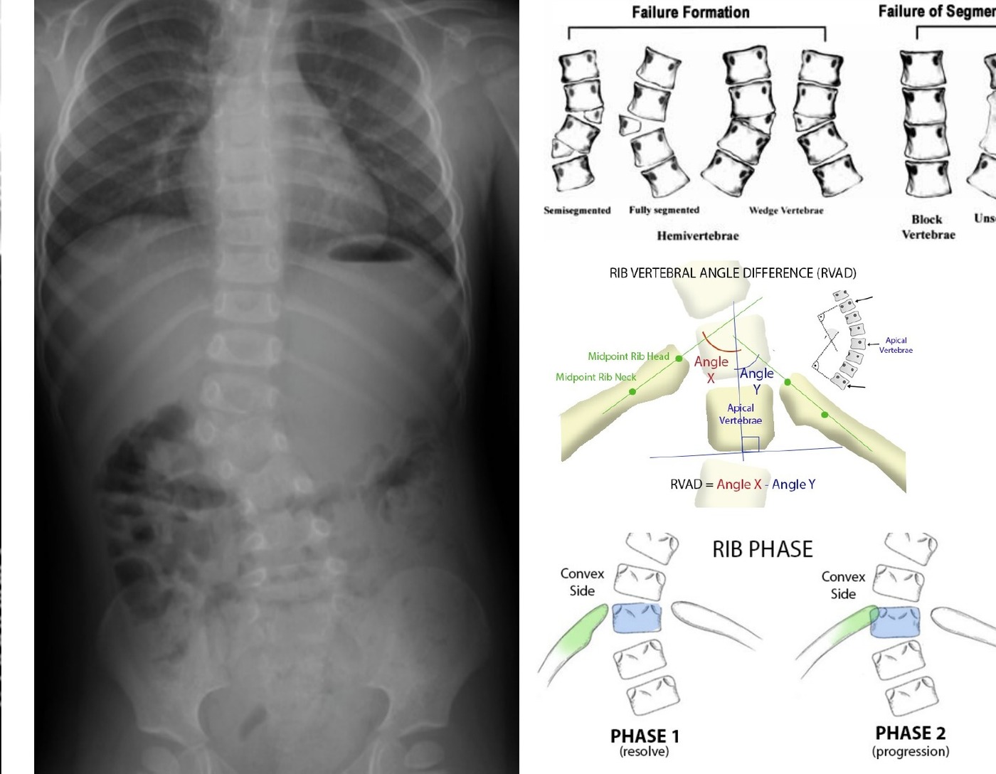 Ultrasound image