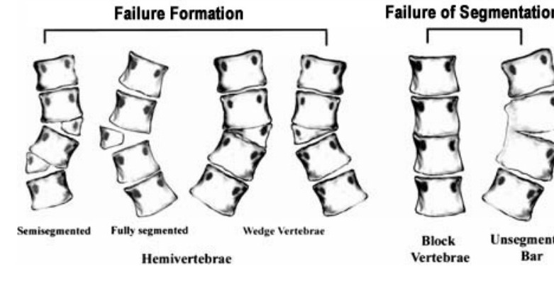 Classification / diagram