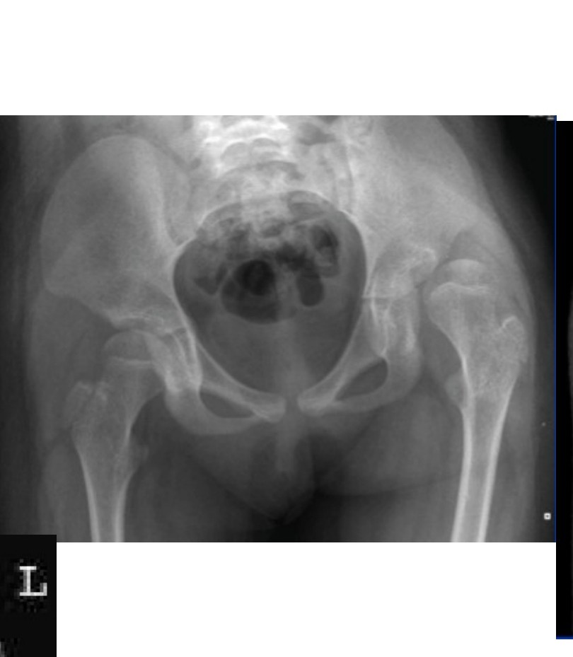 Radiograph / imaging