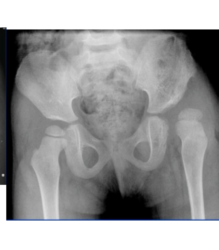 Radiograph / imaging