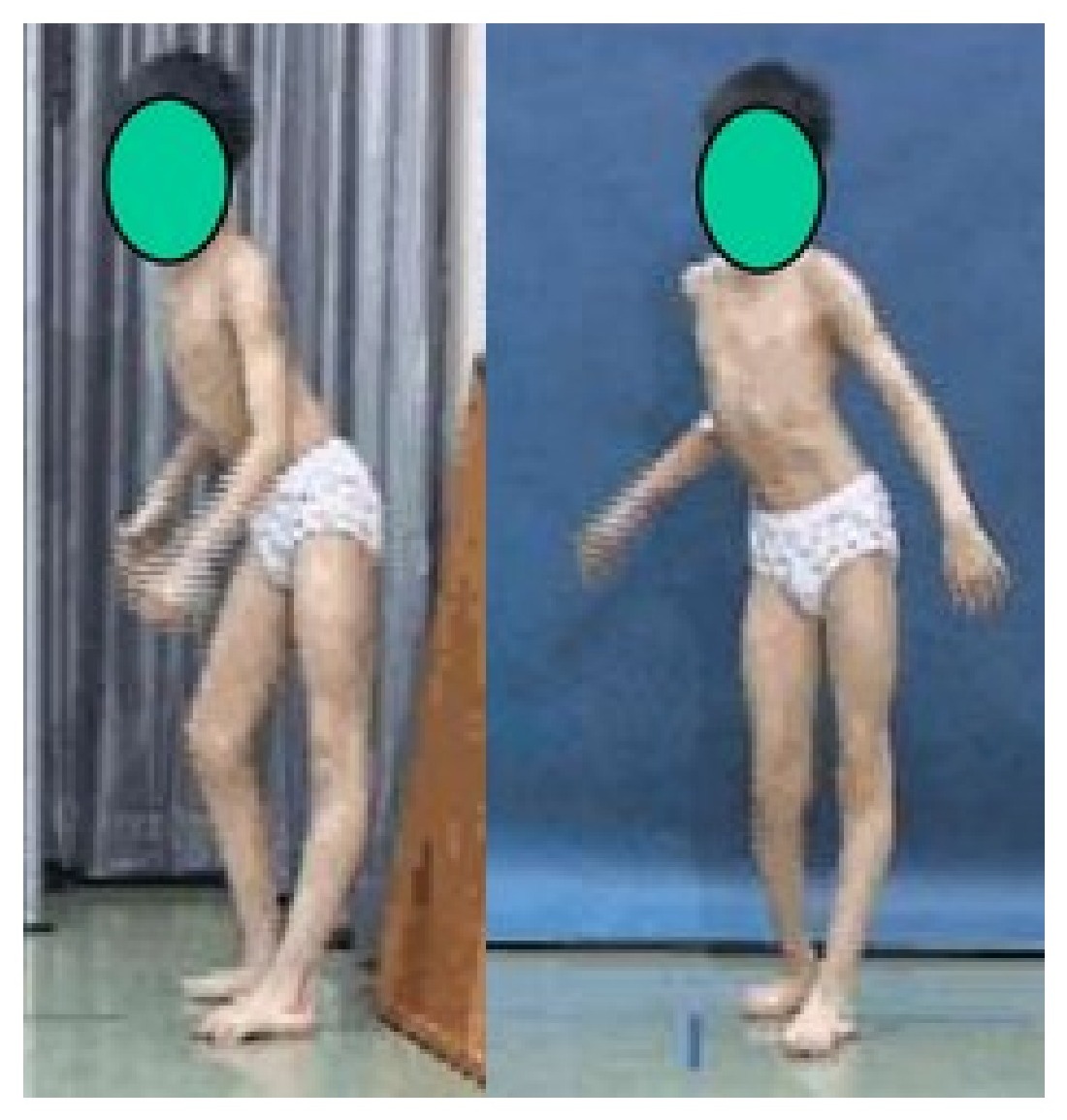 Clinical photograph