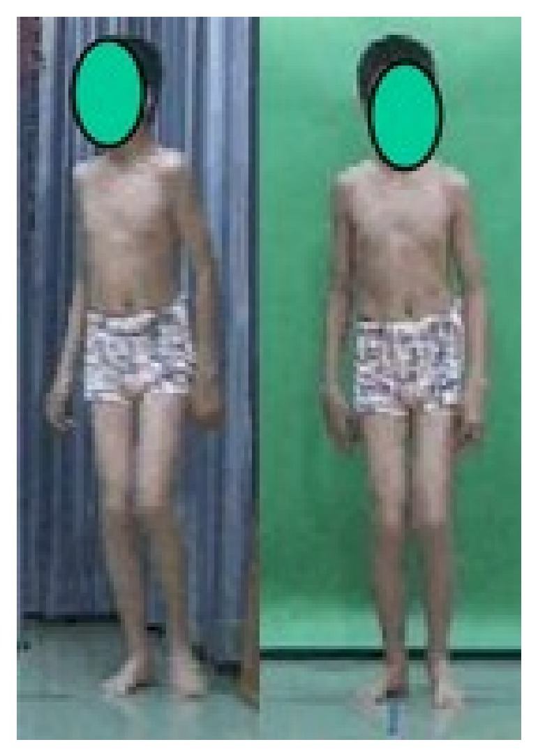 Clinical photograph