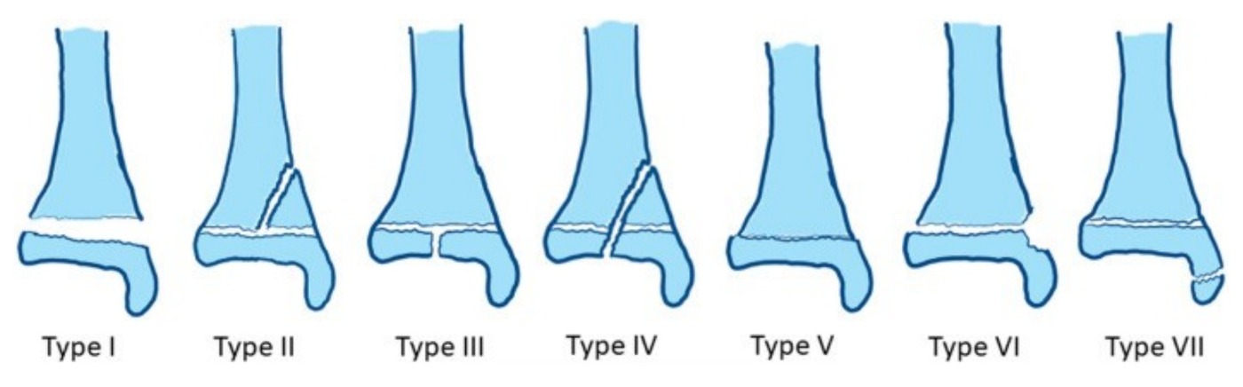 Classification / diagram