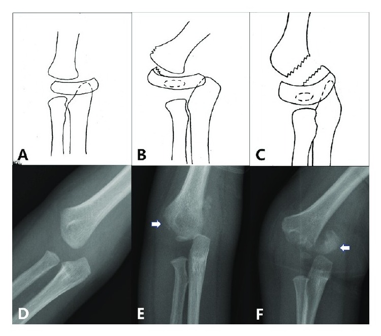 Classification / diagram