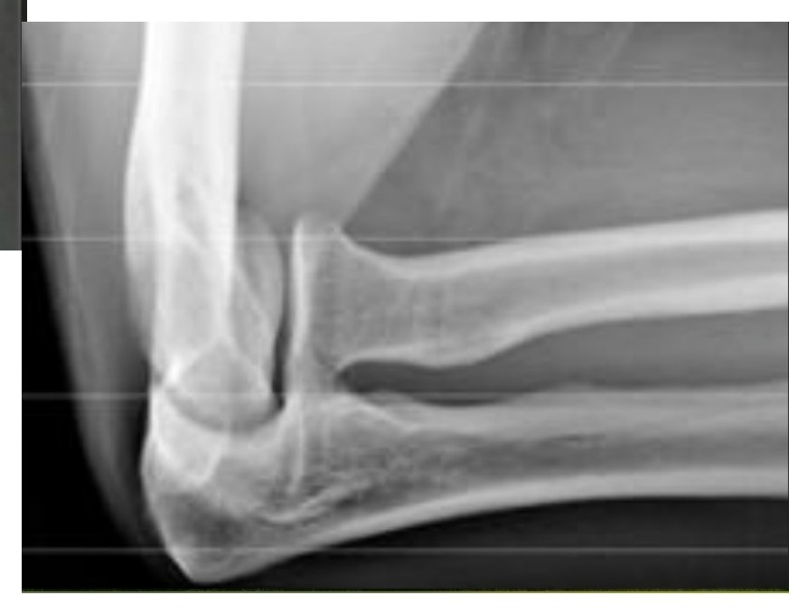 Radiograph / imaging