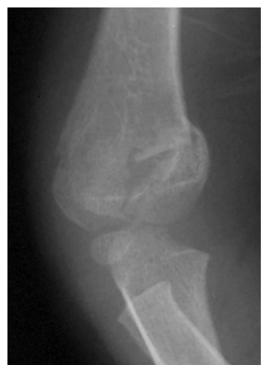 Radiograph / imaging