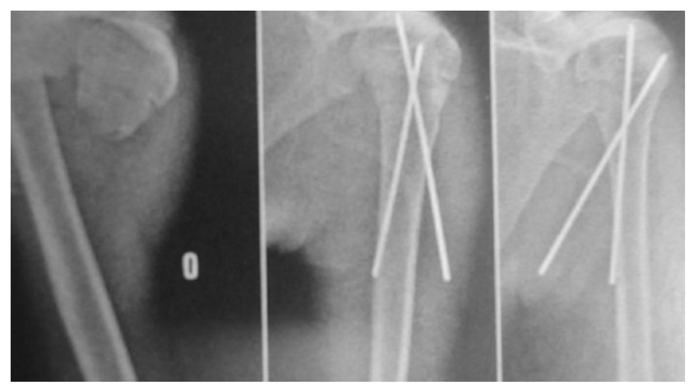 Radiograph / imaging