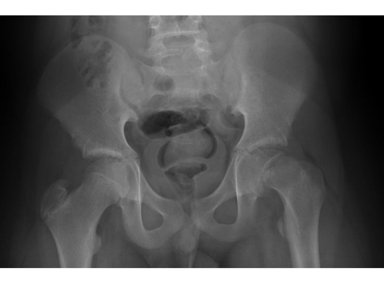 Slide 13 thumbnail