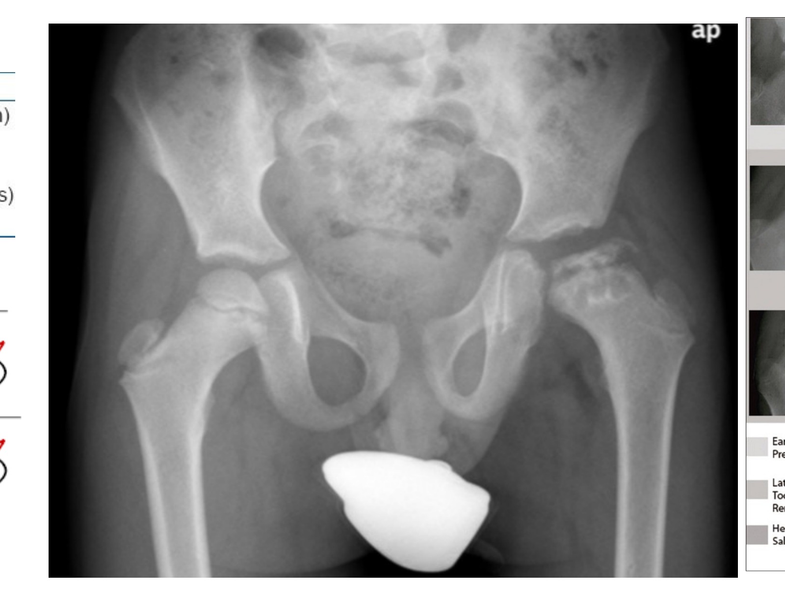 Slide 15 thumbnail