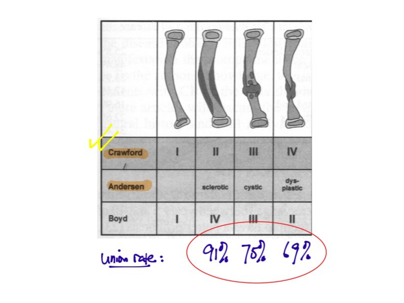 Slide 25 thumbnail