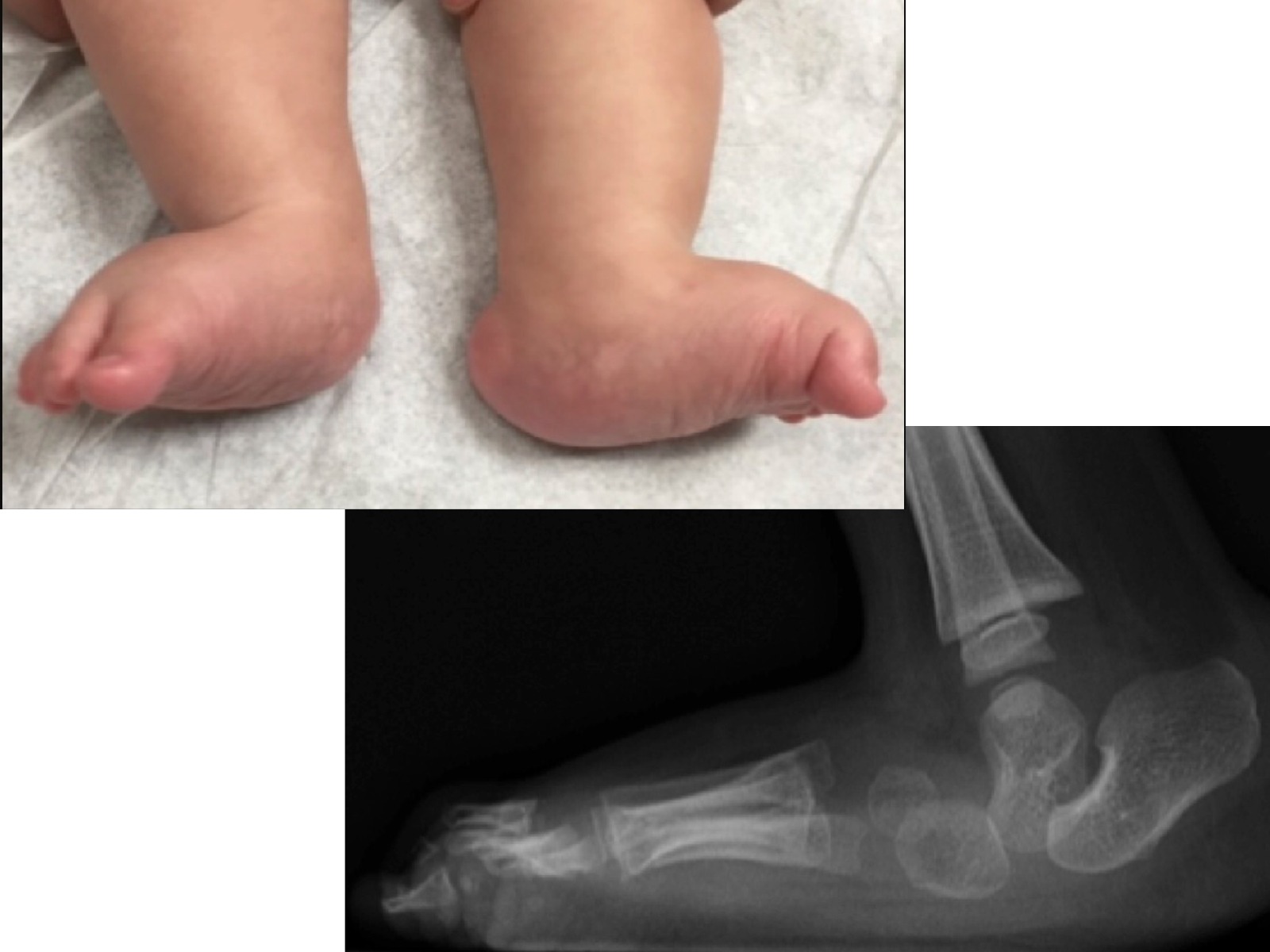 Slide 35 thumbnail
