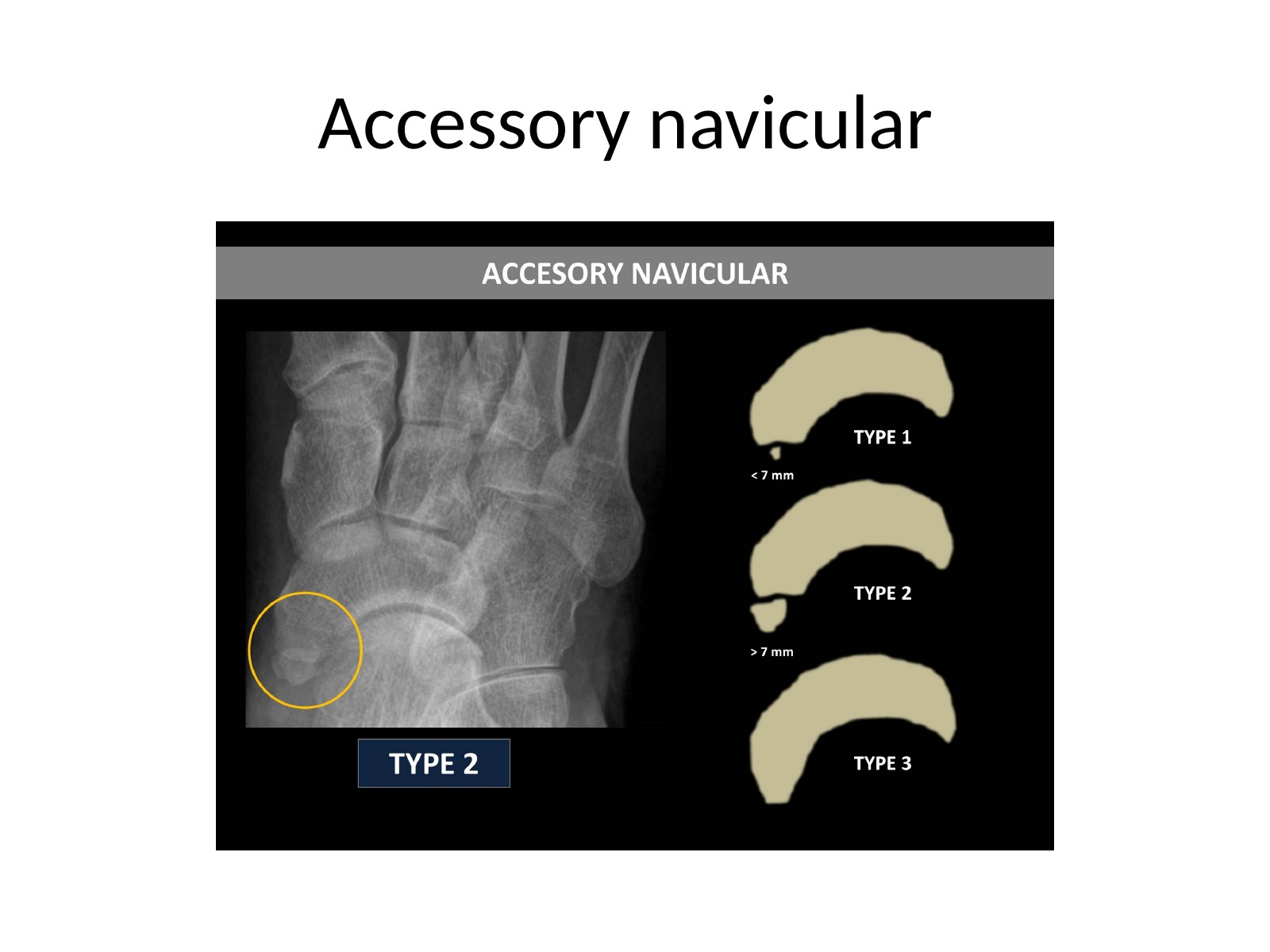 Slide 37 thumbnail