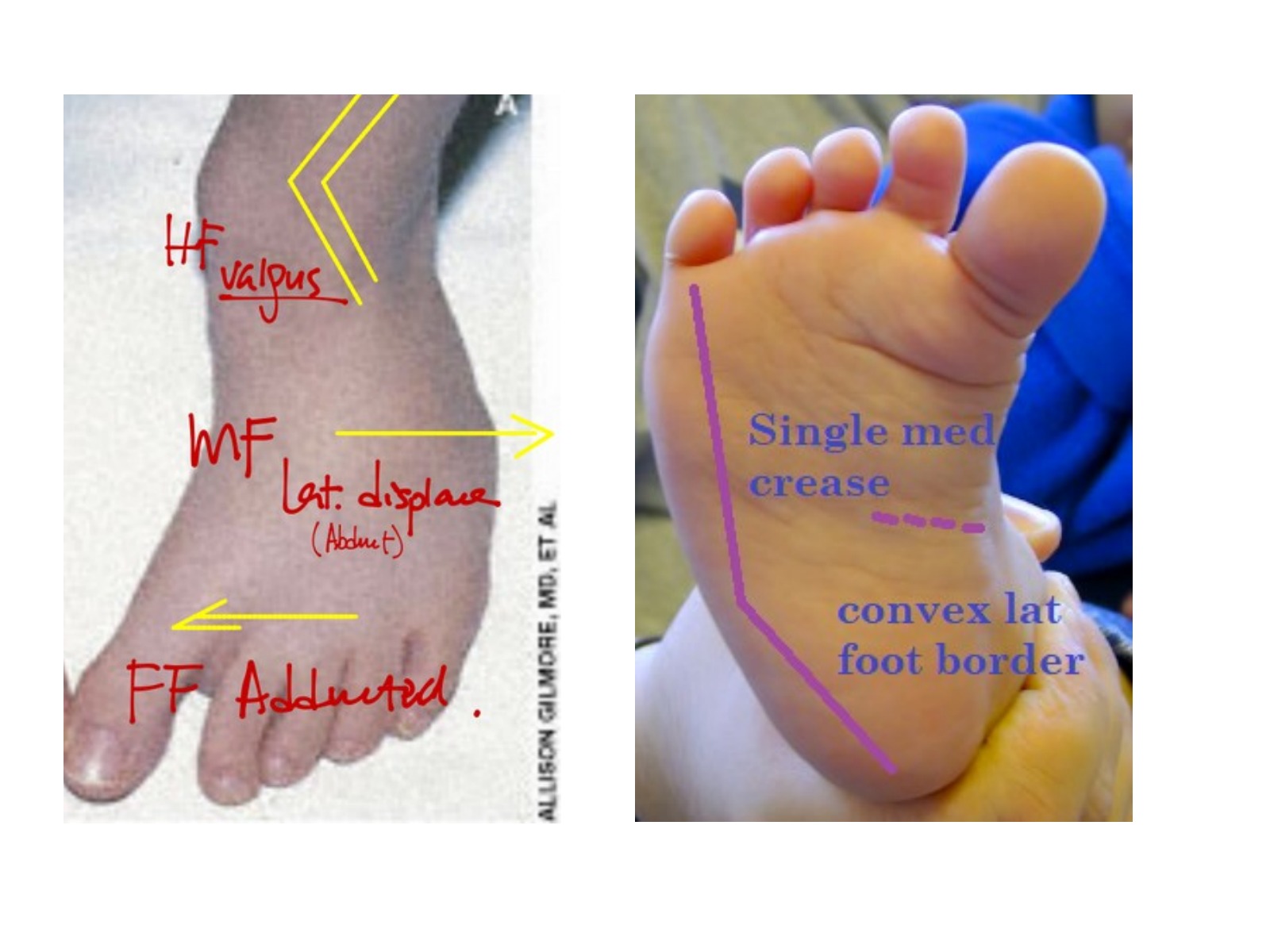 Slide 39 thumbnail