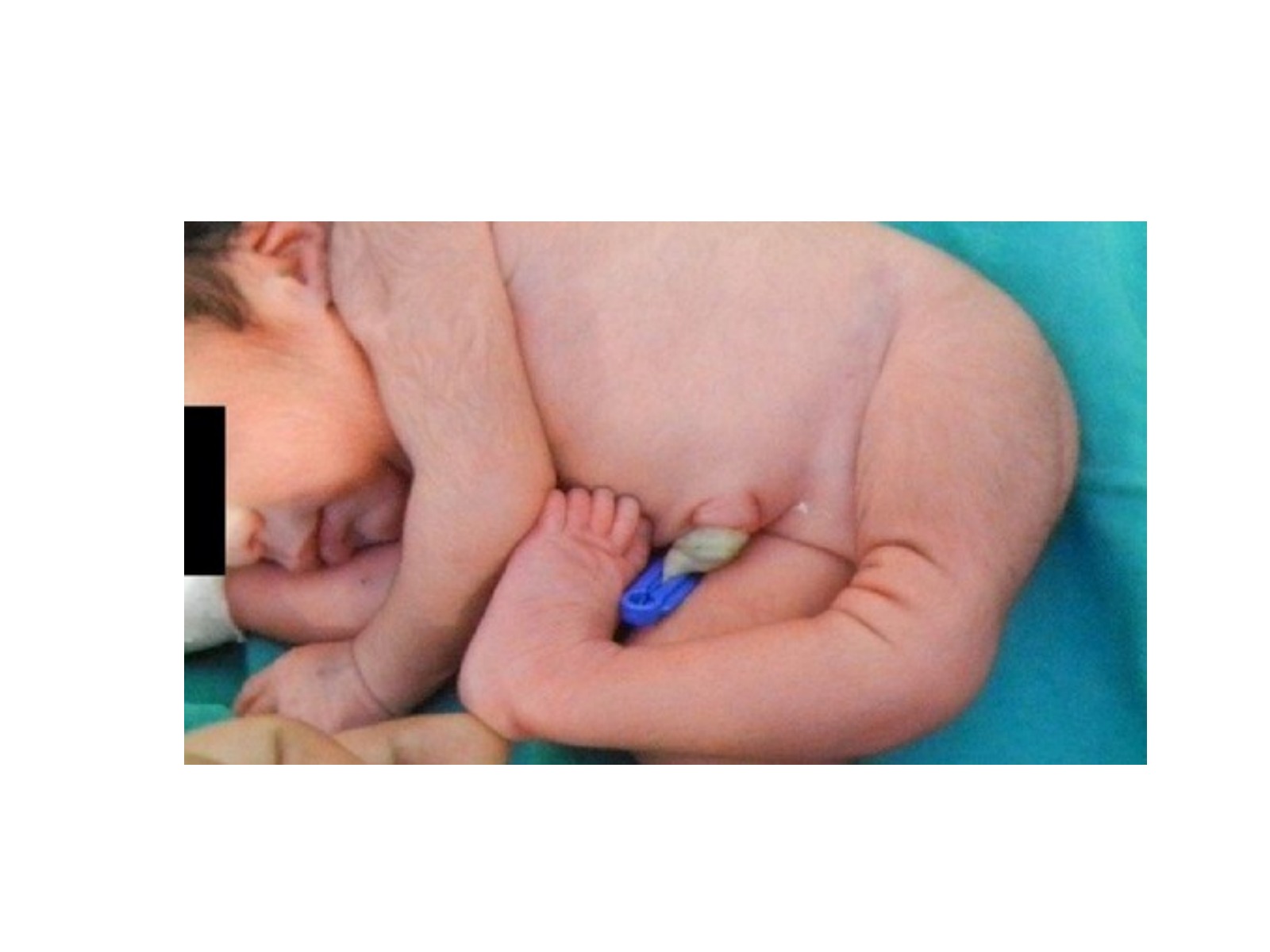 Slide 45 thumbnail