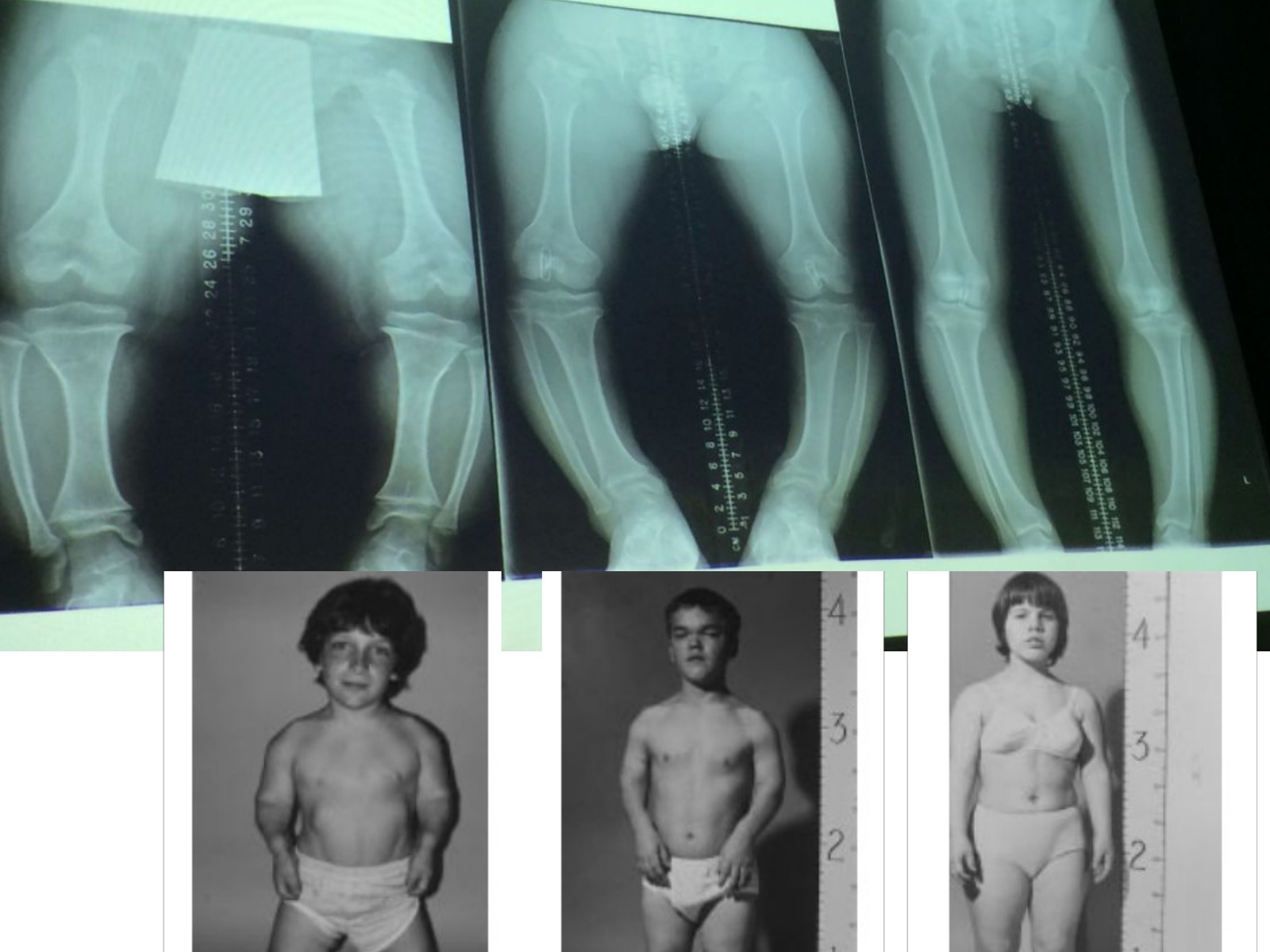 Slide 62 thumbnail