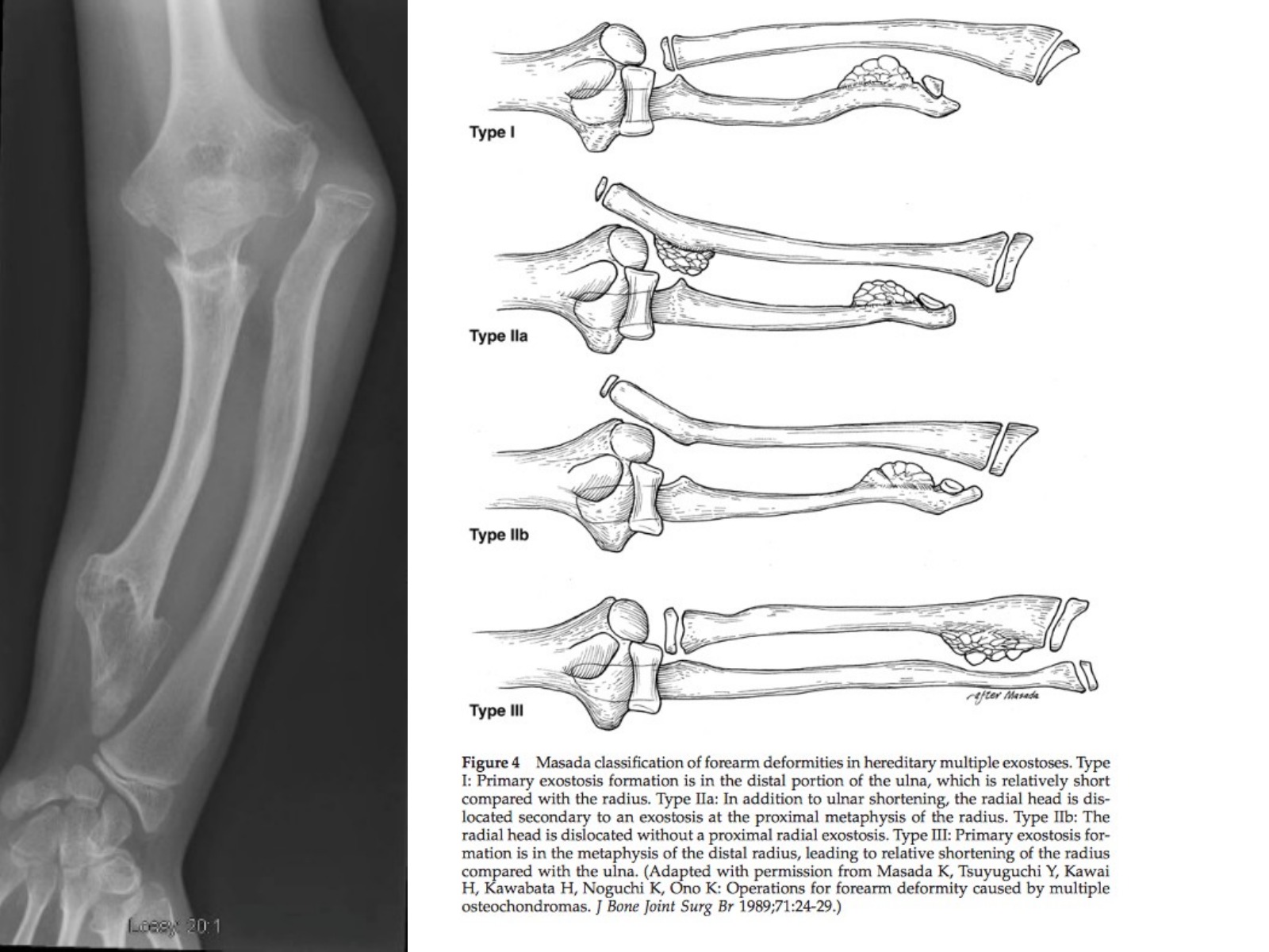 Slide 67 thumbnail