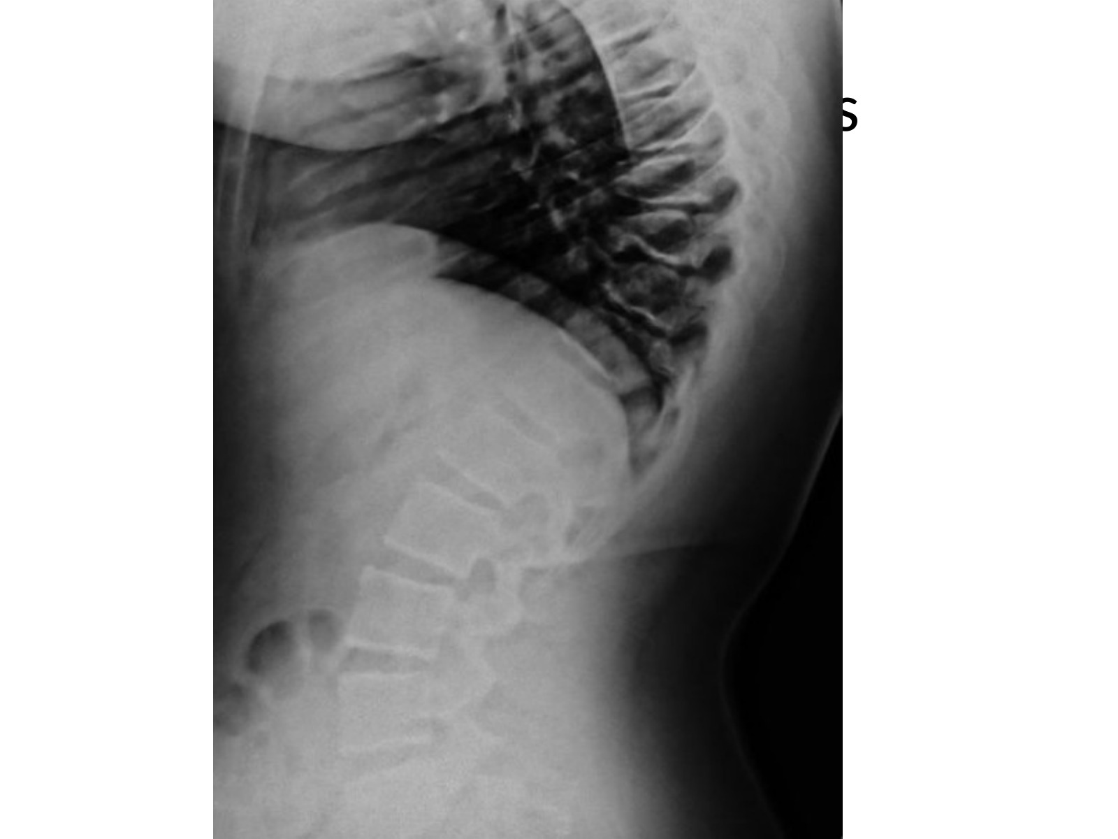 Slide 93 thumbnail