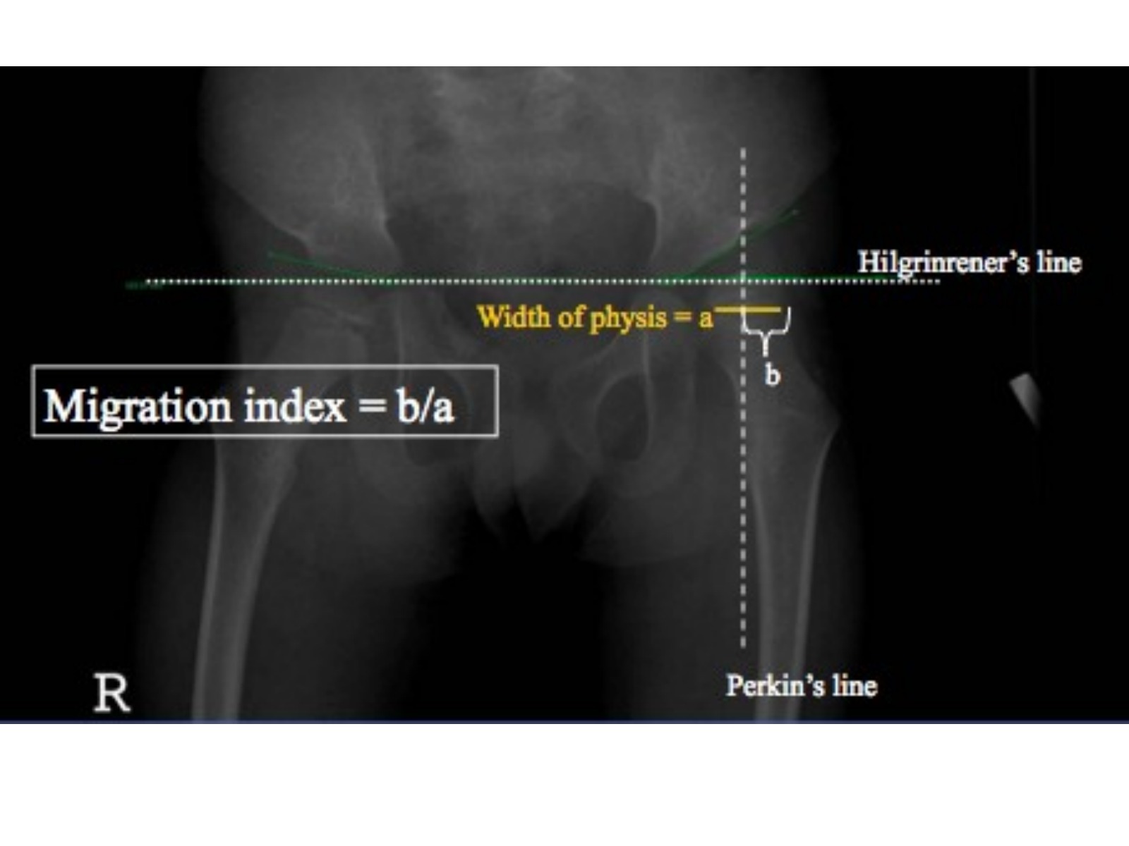 Slide 101 thumbnail