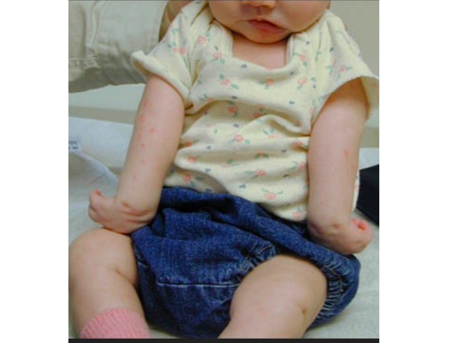 Slide 111 thumbnail