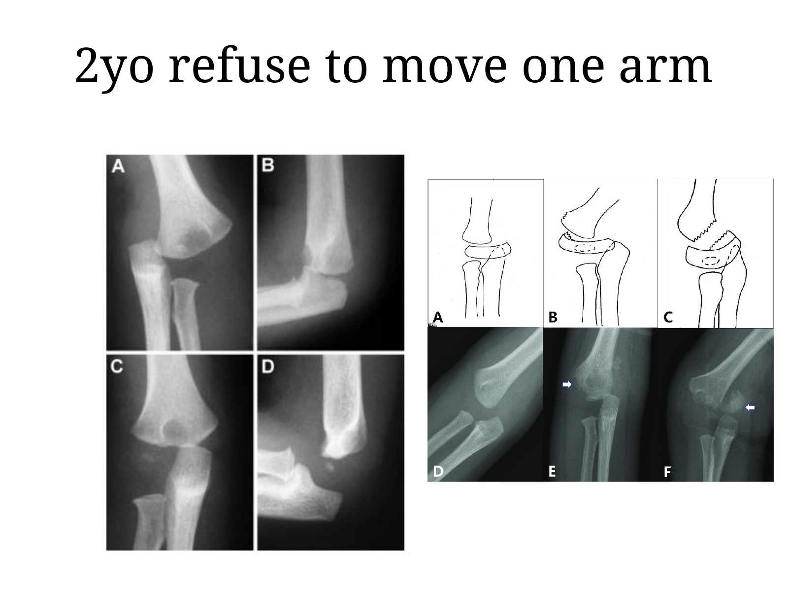 Slide 115 thumbnail