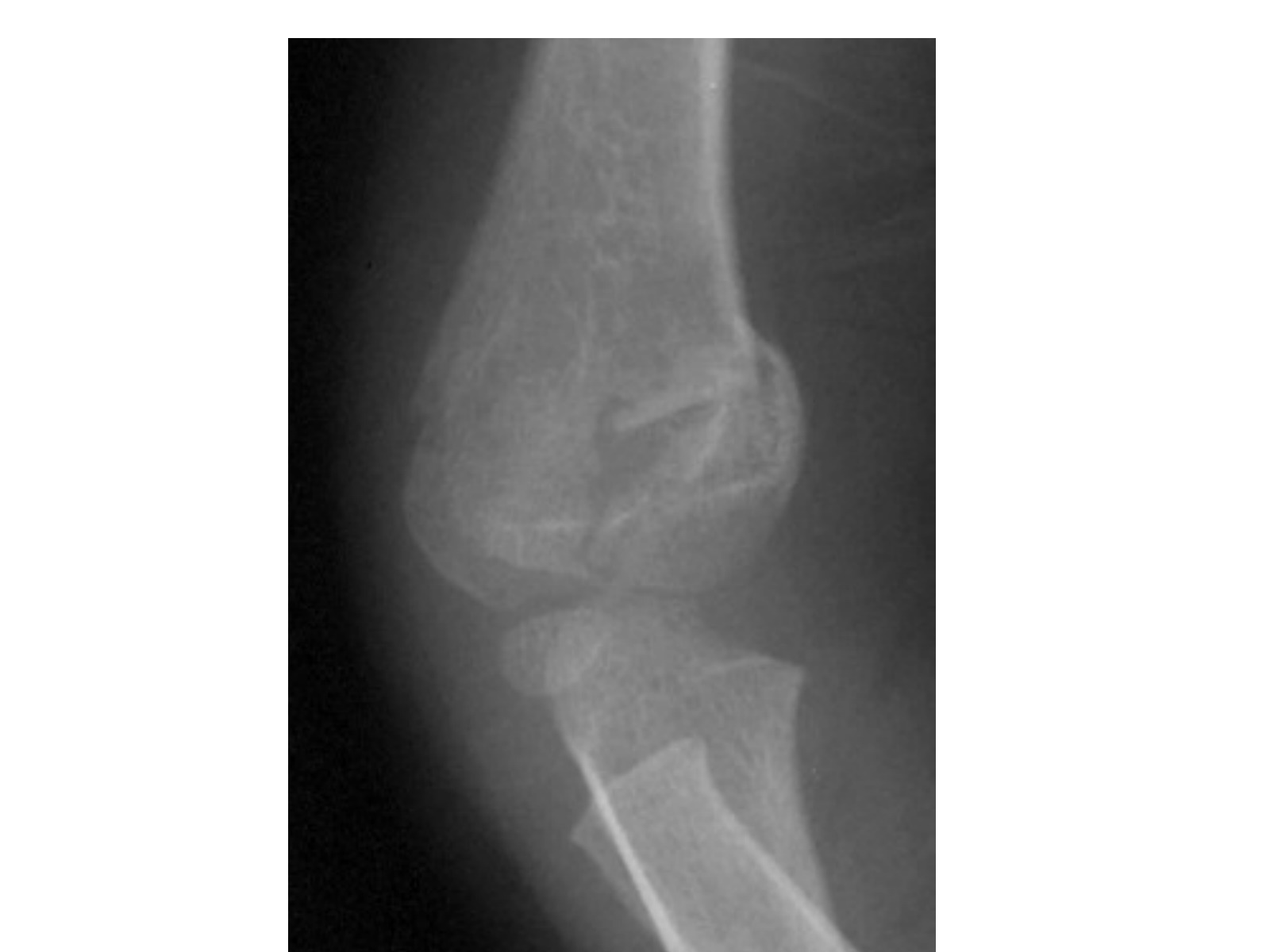 Slide 126 thumbnail