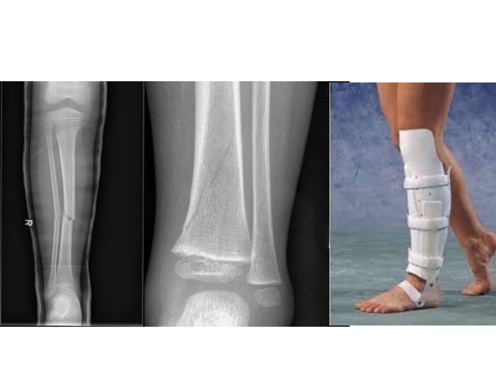 Slide 137 thumbnail