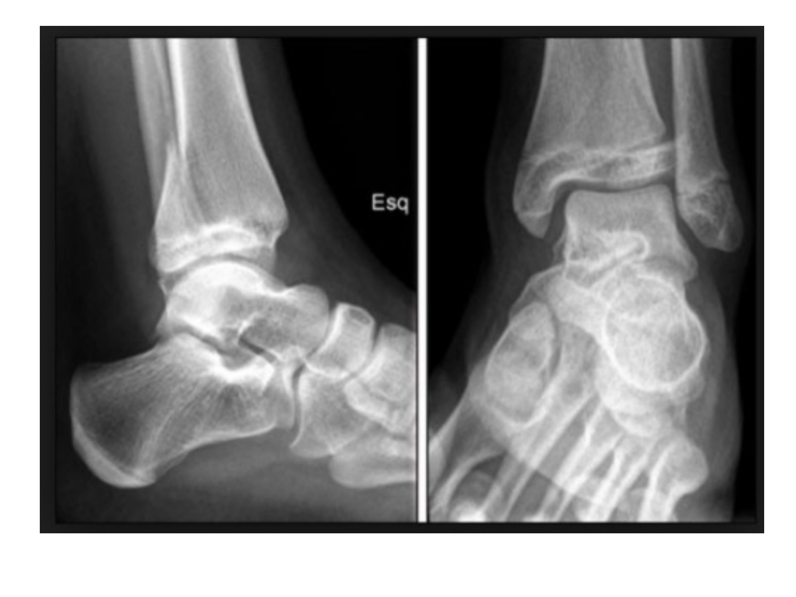Slide 138 thumbnail